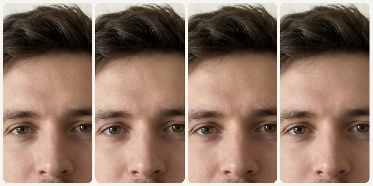 AI Blemish Remover use case - Instagram Story Touch-Up
